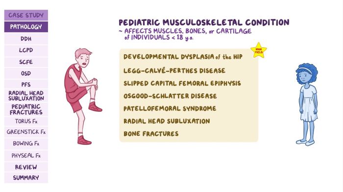 Nclex questions for musculoskeletal disorders